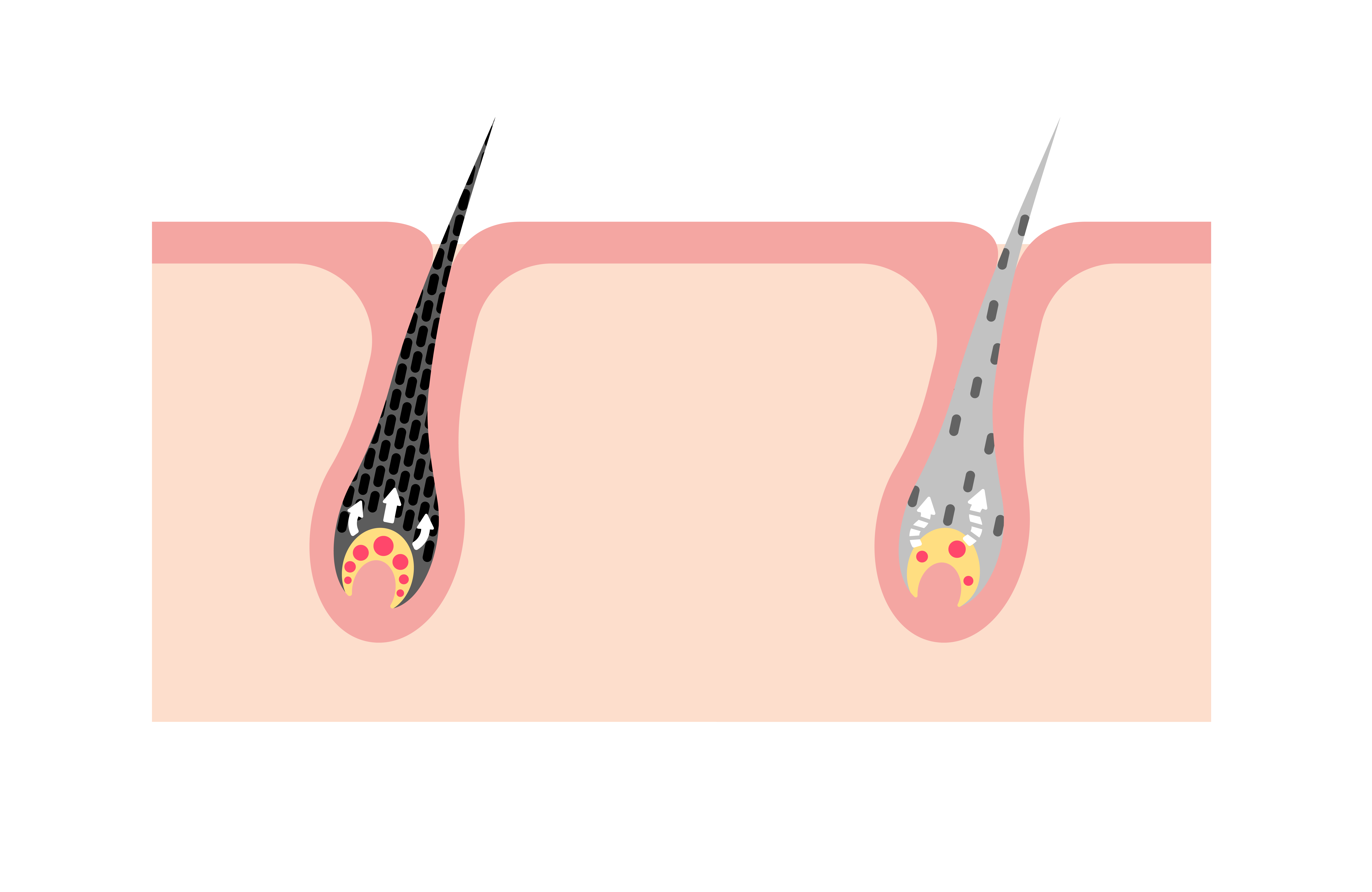 メラニン色素と毛根の仕組み